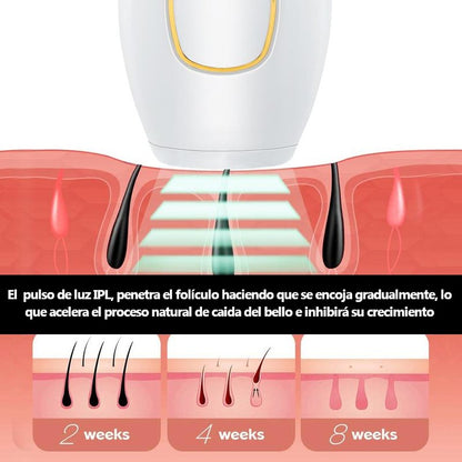 Depilador Laser ILP